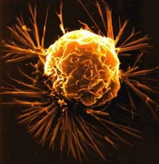 Científicos desarrollan técnica que obliga a envejecer y morir a células cancerígenas