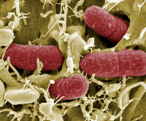 bacteria intestinal E coli Enterohemorrágica