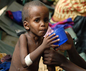 La desnutrición se ceba con 500 millones de niños en todo el mundo