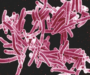 Alerta: Se desarrolla un brote de tuberculosis incurable 
